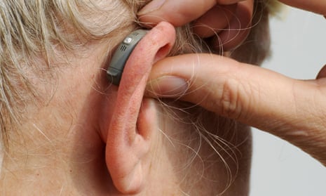 Modern small hearing aid behind the ear of a woman