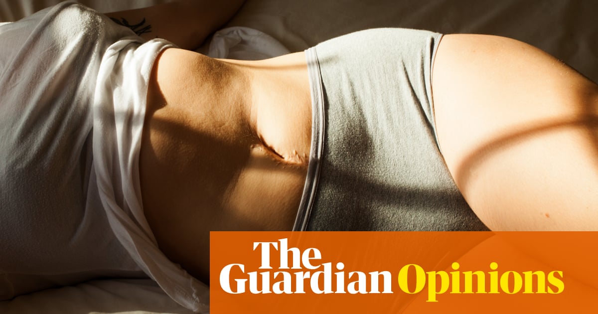 The truth is that most bellies do, in fact, bulge. We need to see that on our screens | Dejan Jotanovic
