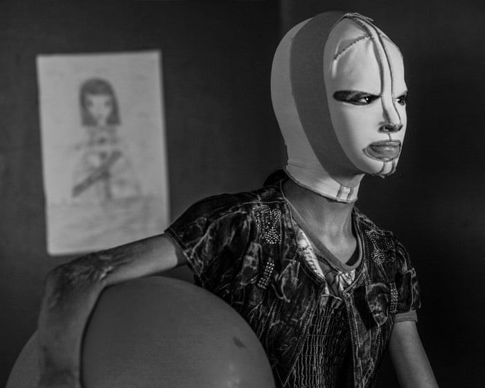 Photographer Alessio Mamo on his portrait of a young Iraqi war survivor