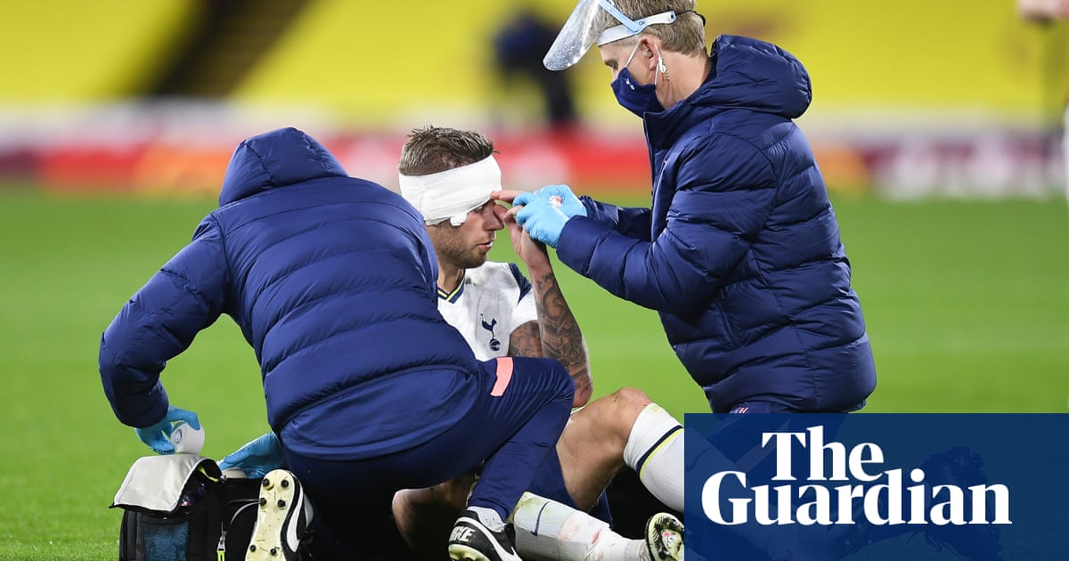 Fifas concussion substitutes trial to be implemented in Premier League