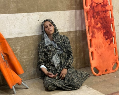 A Palestinian woman wounded in an Israeli strike on a camp for displaced people near Khan Younis.