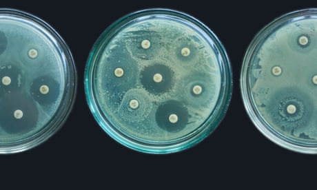 A series of antimicrobial resistance susceptibility tests. resistance susceptibility tests by diffusion kirby bauer<br>kirby bauer method. Antibiotic Sensitivity Test. Methods in Detecting Antimicrobial Resistance using petri dish. multidrug resistance