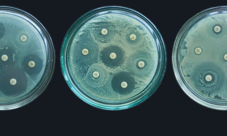 A series of antimicrobial resistance susceptibility tests.