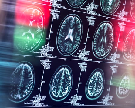 An image showing scans of the brain