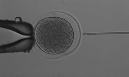 A kangaroo egg about to be injected with a single sperm cell