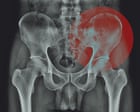 Do we really ‘hold tension’ in our hips?