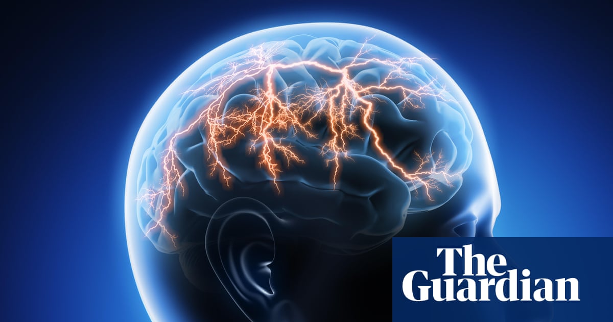 Why migraines are often undiagnosed | Letters