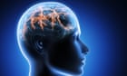 Neurological conditions now leading cause of ill-health worldwide, finds study