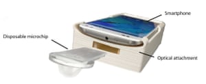 The test is an inexpensive smartphone attachment that quickly and accurately evaluates semen samples for fertility testing.
