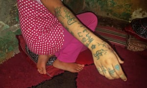 Moroccan teenager Khadija, 17, displays the tattoos she says were inflicted by men who kidnapped and raped her.