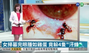 Taiwanese television showing the bees living in the persons eye.