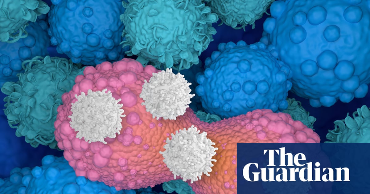 Protective immune cells in breastfeeding women identified as guard against breast cancer, new research finds