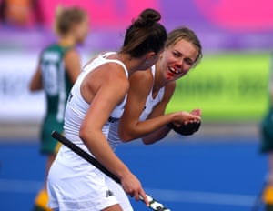New Zealand’s Frances Davies after sustaining a facial injury during the hockey.