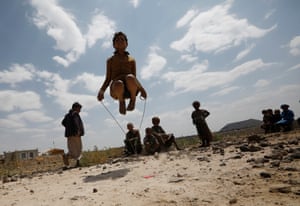 A kid plays with a skipping enactment successful a campy for internally displaced persons connected the outskirts of Sana’a successful Yemen