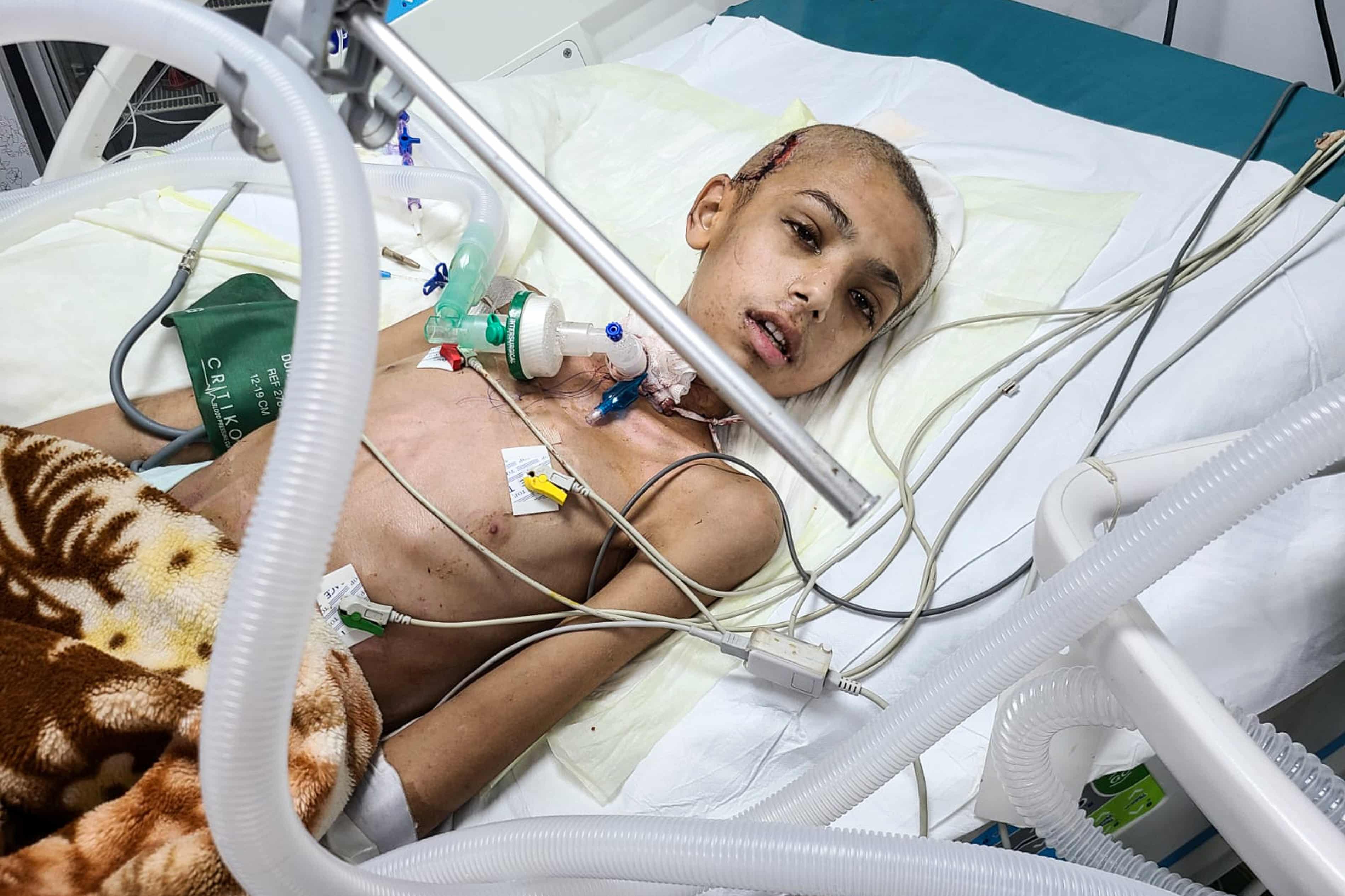 ‘Not a normal war’: doctors say children have been targeted by Israeli snipers in Gaza (theguardian.com)