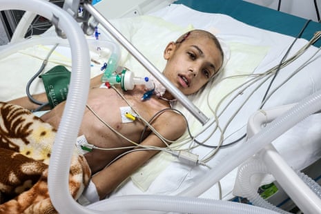 A child recovers in a hospital bed