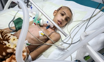 a child recovers in a hospital bed