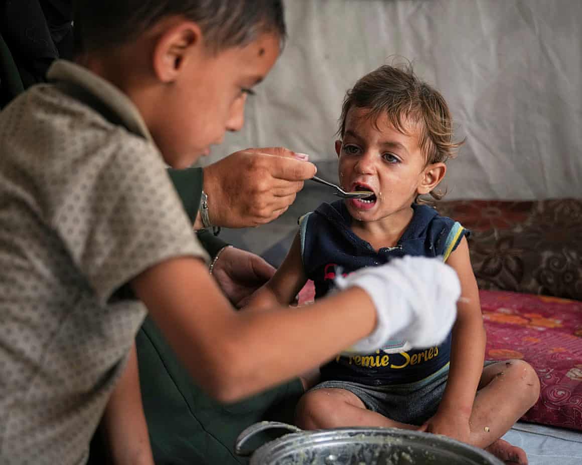 A little boy in Gaza is fed with a spoon