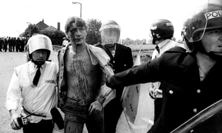 An injured miner being arrested during the Orgreave.