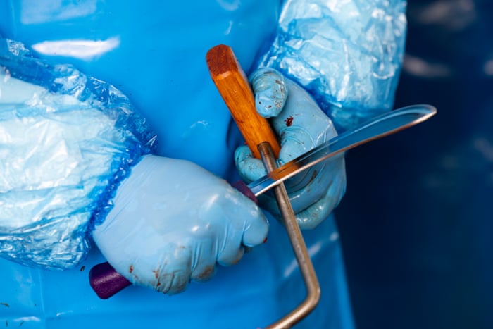 Dissecting the world’s rarest whale – in pictures Te Kaurinui Parata, a whale expert and Ngāti Wai representative, holds a knife and a blubber hook that will be used to remove the epaxial muscles from the left side of the animal.Photograph: Derek Morrison