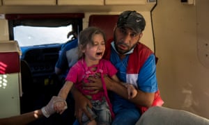 A girl who survived a barrel bomb attack in the Bustan al Qasr neighbourhood, Aleppo.