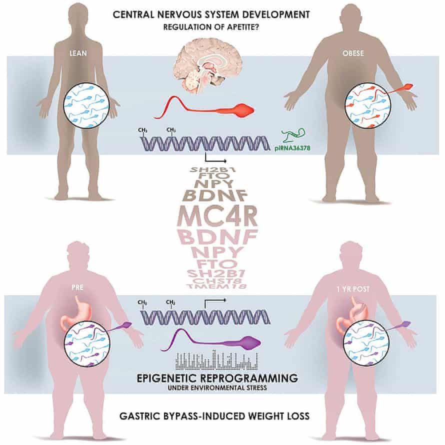 Sperm from obese and lean men carry different biochemical markers that alter the activity of genes and can be inherited. Genes controlling brain development and appetite are thought to be most affected.