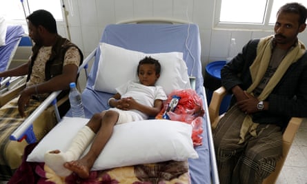 A Yemeni child receives medical treatment after he was injured by the airstrike on the school bus.