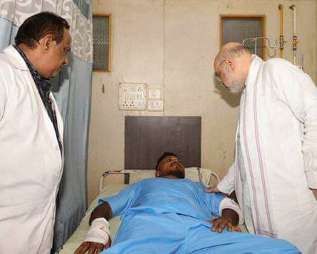 Vishwash Kumar Ramesh in hospital in Ahmedabad