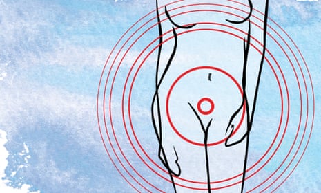 Illustration of a woman's body with red circles around the groin