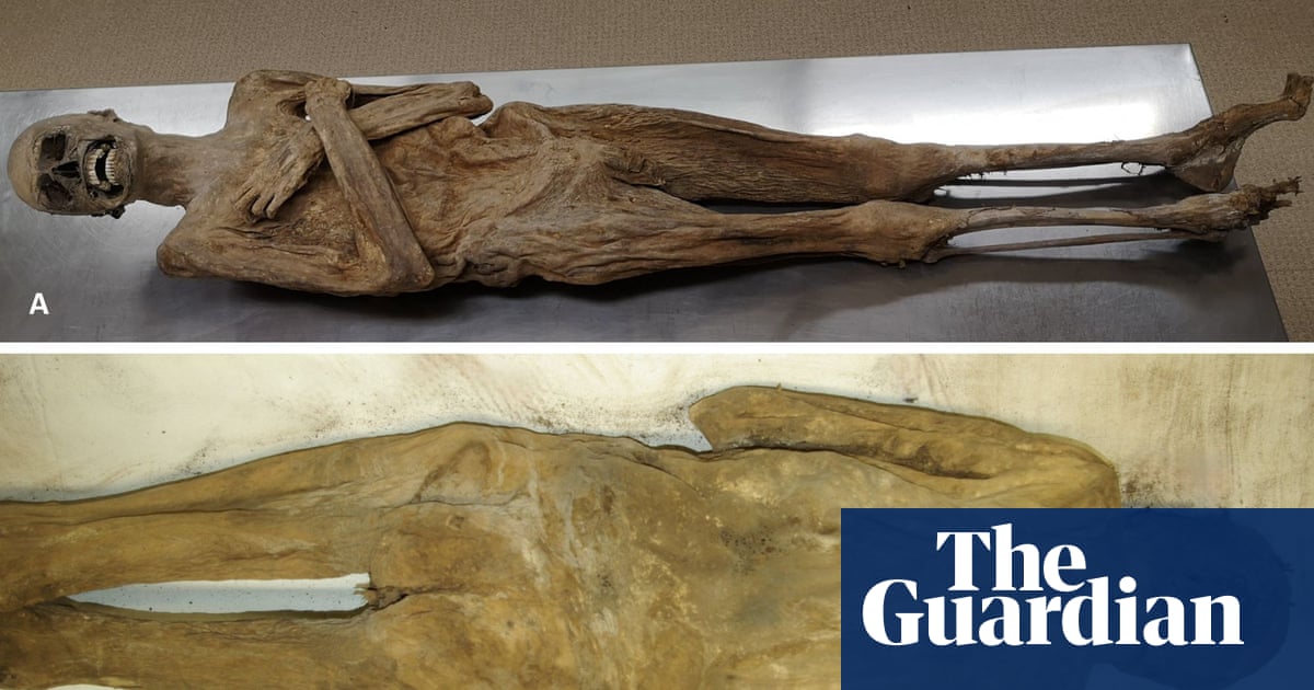Mummy mystery solved: ‘air-dried’ priest was embalmed via rectum