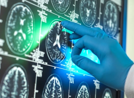 Hand of scientist wearing surgical glove examining MRI scan of patient