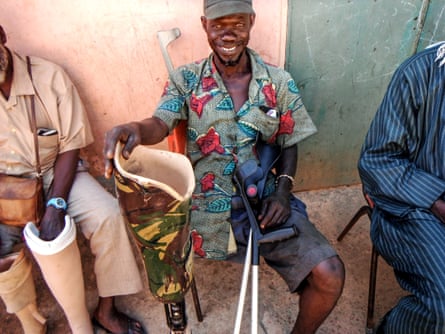Musa, a mechanic who lost his leg in an accident at work, is a recipient of a prosthetic leg.