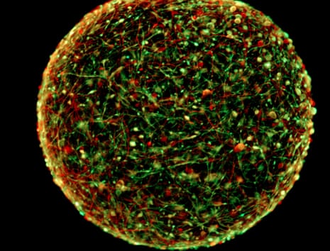 Each ball of human brain cells - in all about the size of the head of a ballpoint pen - “represents more or less a two-month-old brain” of a foetus.