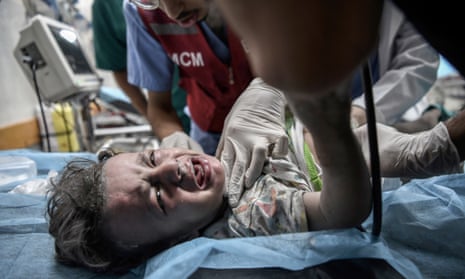 A Palestinian child is treated in Nasser Hospital.