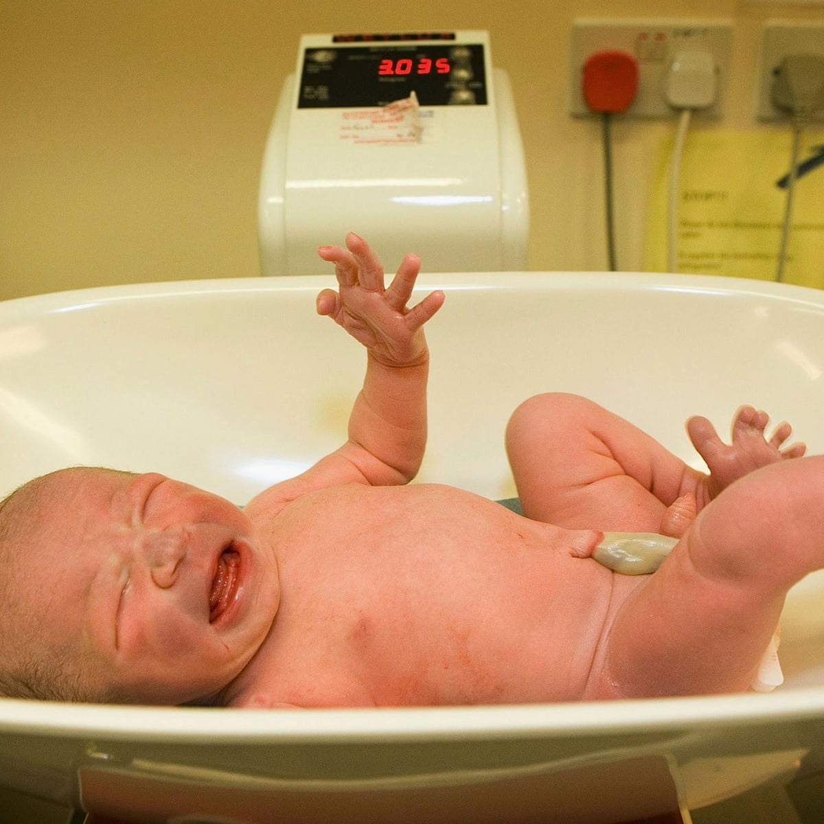 Birth Weight Influenced By Genes Linked To Disease Risk