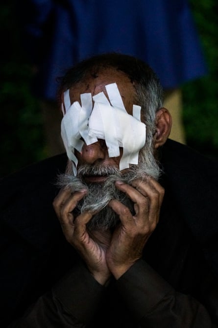 Adnan Thanon Younis, who was blinded by an exploding shell in Mosul.