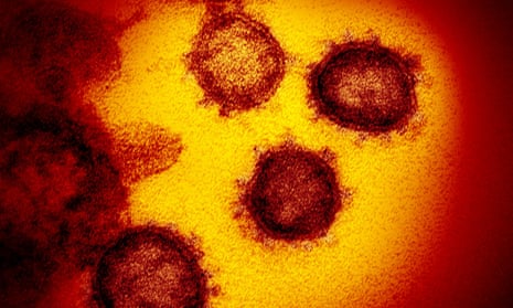 SARS-CoV-2, the virus that causes Covid-19.