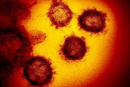 A transmission electron microscope image of the coronavirus