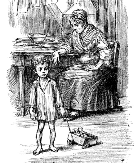 Una ilustración del siglo XIX de un niño con raquitismo.