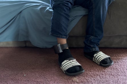 A man’s legs and feet with a monitor attached to his ankle.