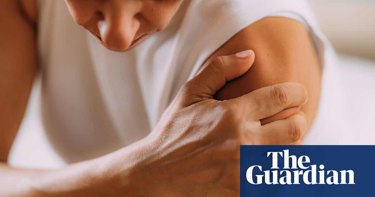 Living with frozen shoulder: ‘It was as if someone had been hitting my arm with a baseball bat’