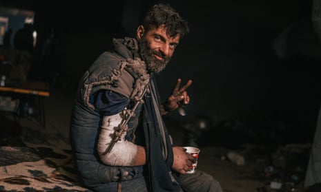 Mykhailo Dianov bearded, dirty and with arm in makeshift cast, makes a V for victory sign while holding a cup of drink