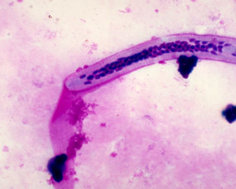 A twisted worm, stained purple, on a slide