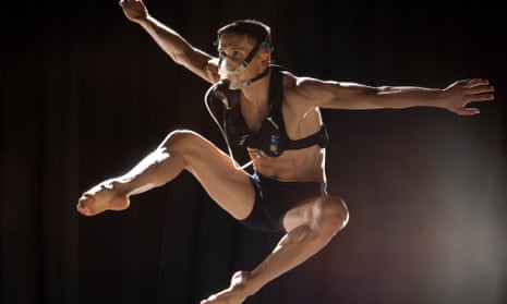 High-tech leg gives woman hope she'll dance one day