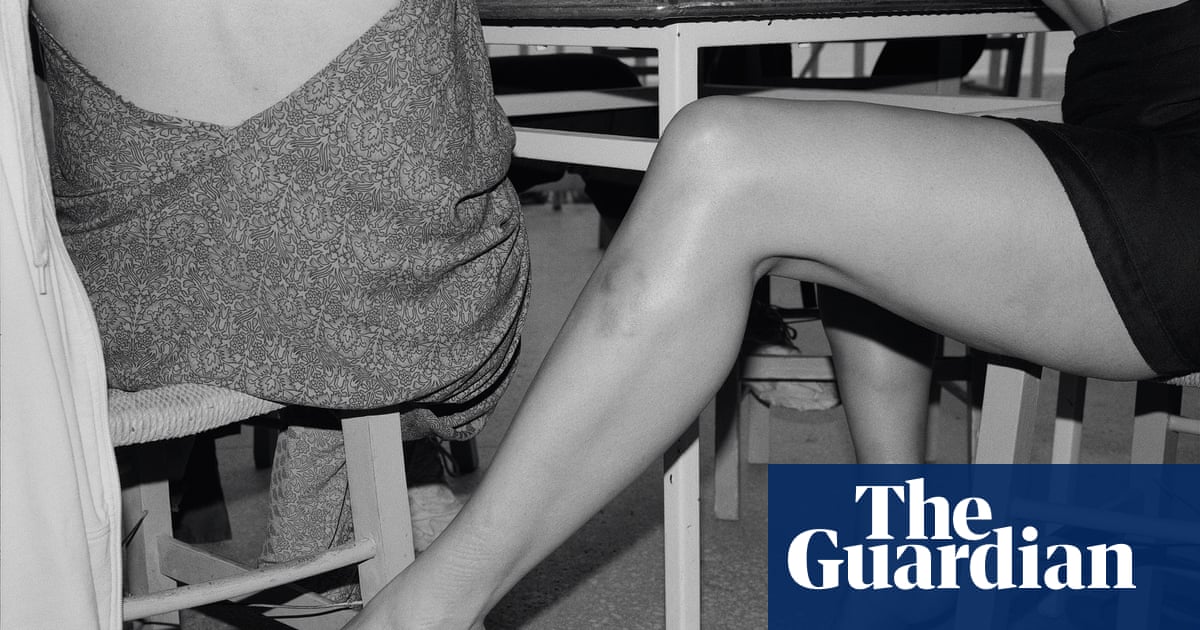 ‘Arms and legs are very expressive, especially with bruises’: the absurdist photography of Yorgos Lanthimos