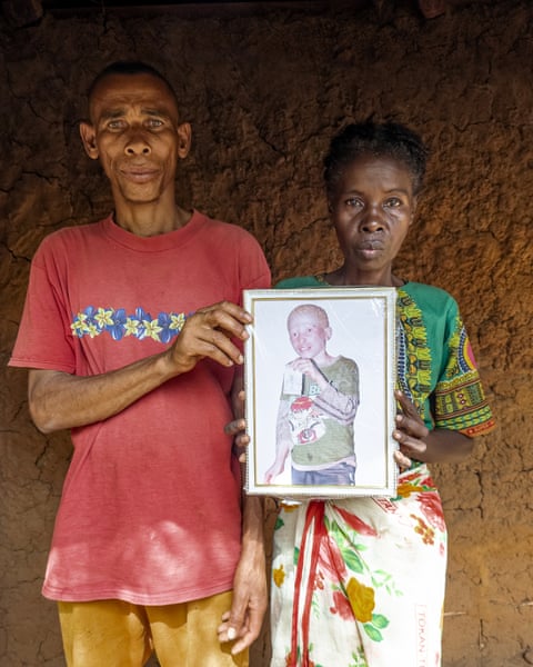 A black man and a black woman holding a framed portrait of a young man with albinism