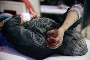 An injured man lies at a medical point in the besieged town of Douma in eastern Ghouta.