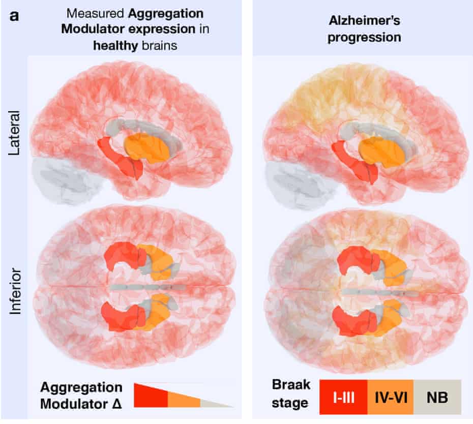 The ‘vulnerability map”’, produced by looking at the levels of certain proteins in the brains of healthy individuals, is consistent with the map of how Alzheimer’s progresses.