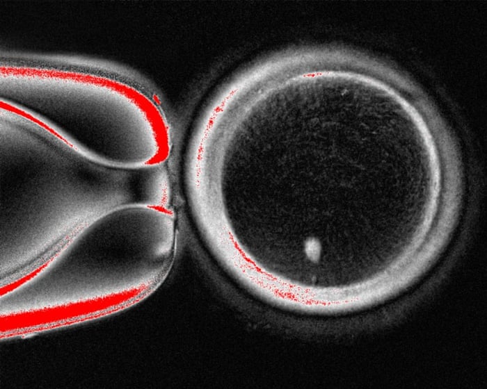 Human skin cells are turned into eggs in fertility breakthrough