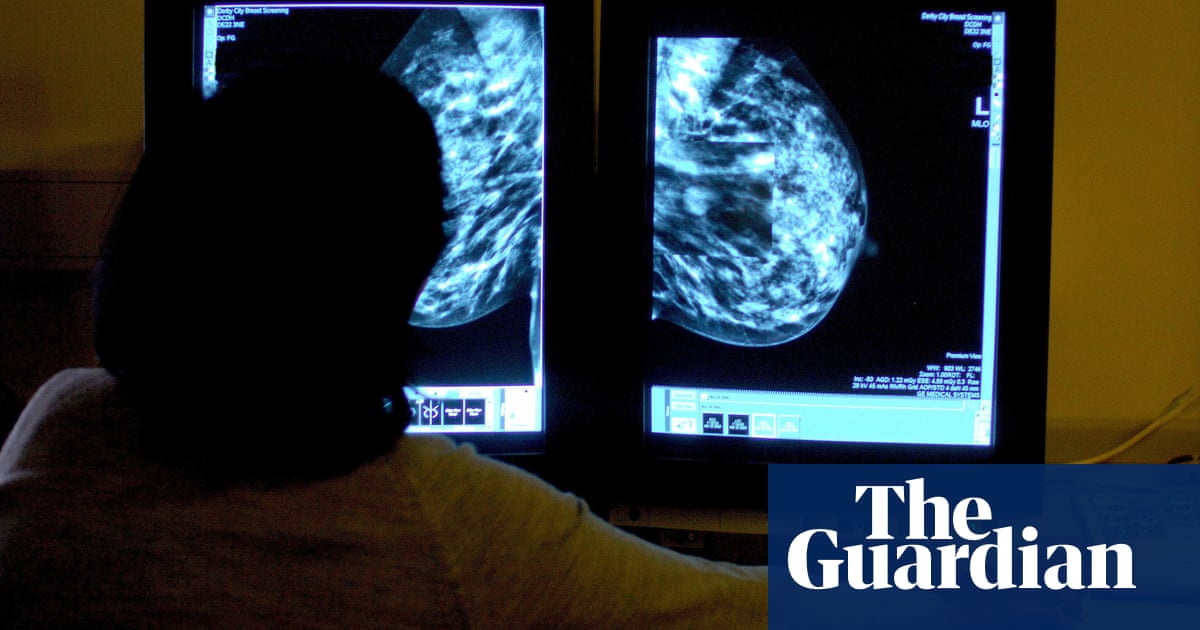 Two breast cancer drugs available on NHS in England after U-turn